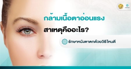 กล้ามเนื้อตาอ่อนแรง