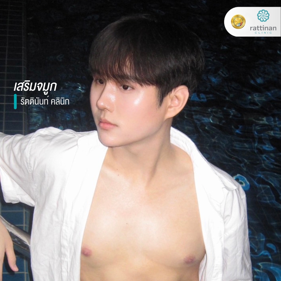 เสริมจมูก รัตตินันท์ รีวิว 2