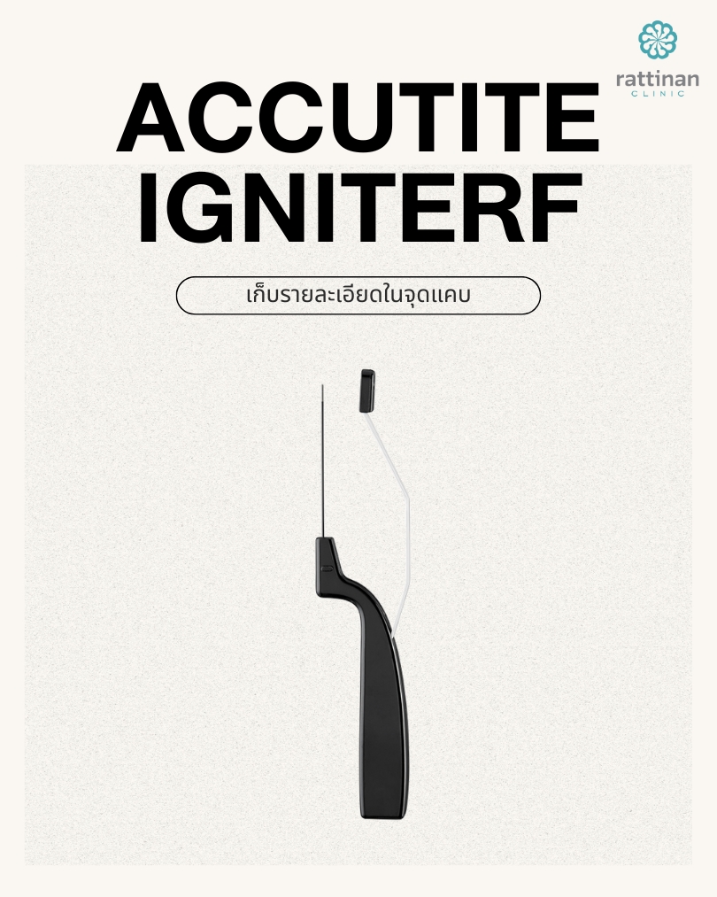 AccuTite IgniteRF
