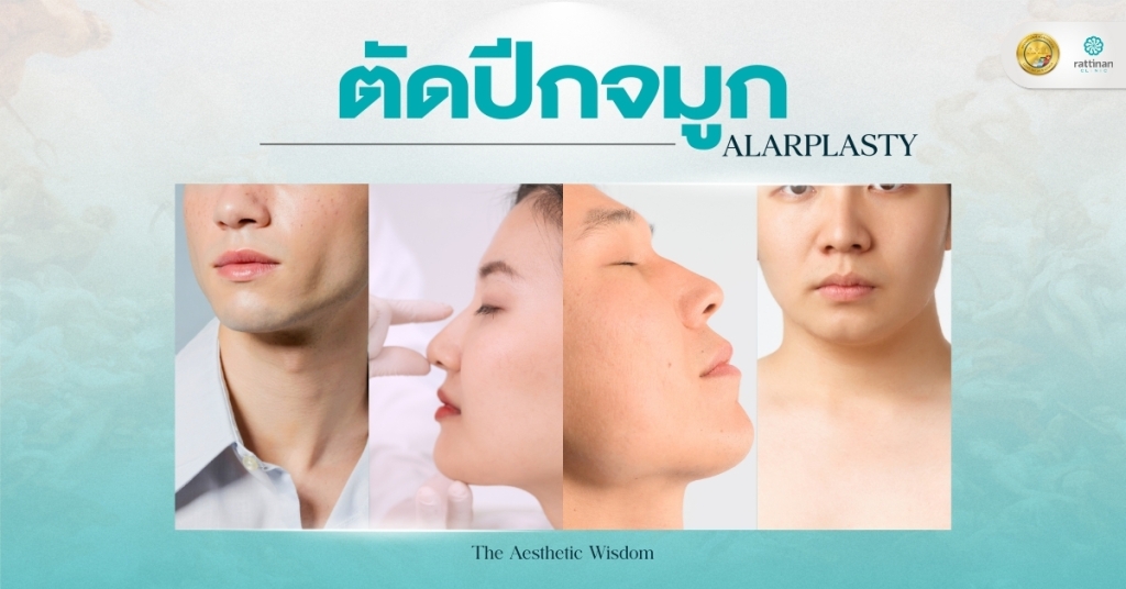 ตัดปีกจมูก