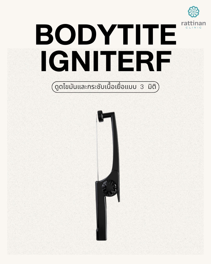 BodyTite IgniteRF