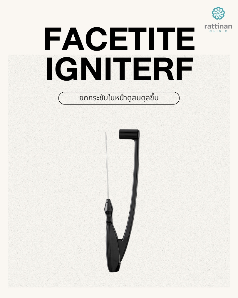 FaceTite IgniteRF