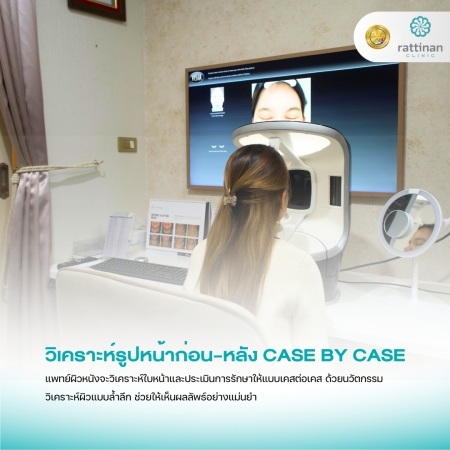 วิเคราะห์รูปหน้าก่อน-หลัง case by case