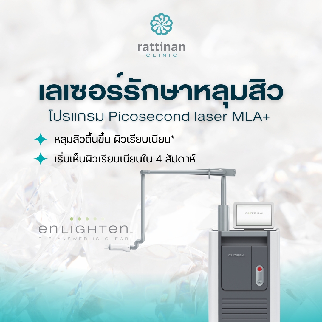 เลเซอร์รักษาหลุมสิว