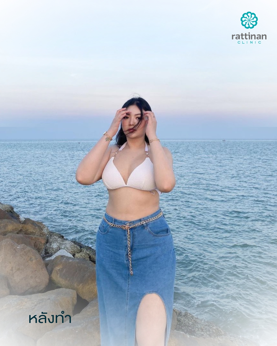 Testimonials Full Body Liposuction - Nangfah after