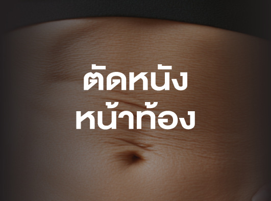 ตัดหนังหน้าท้อง