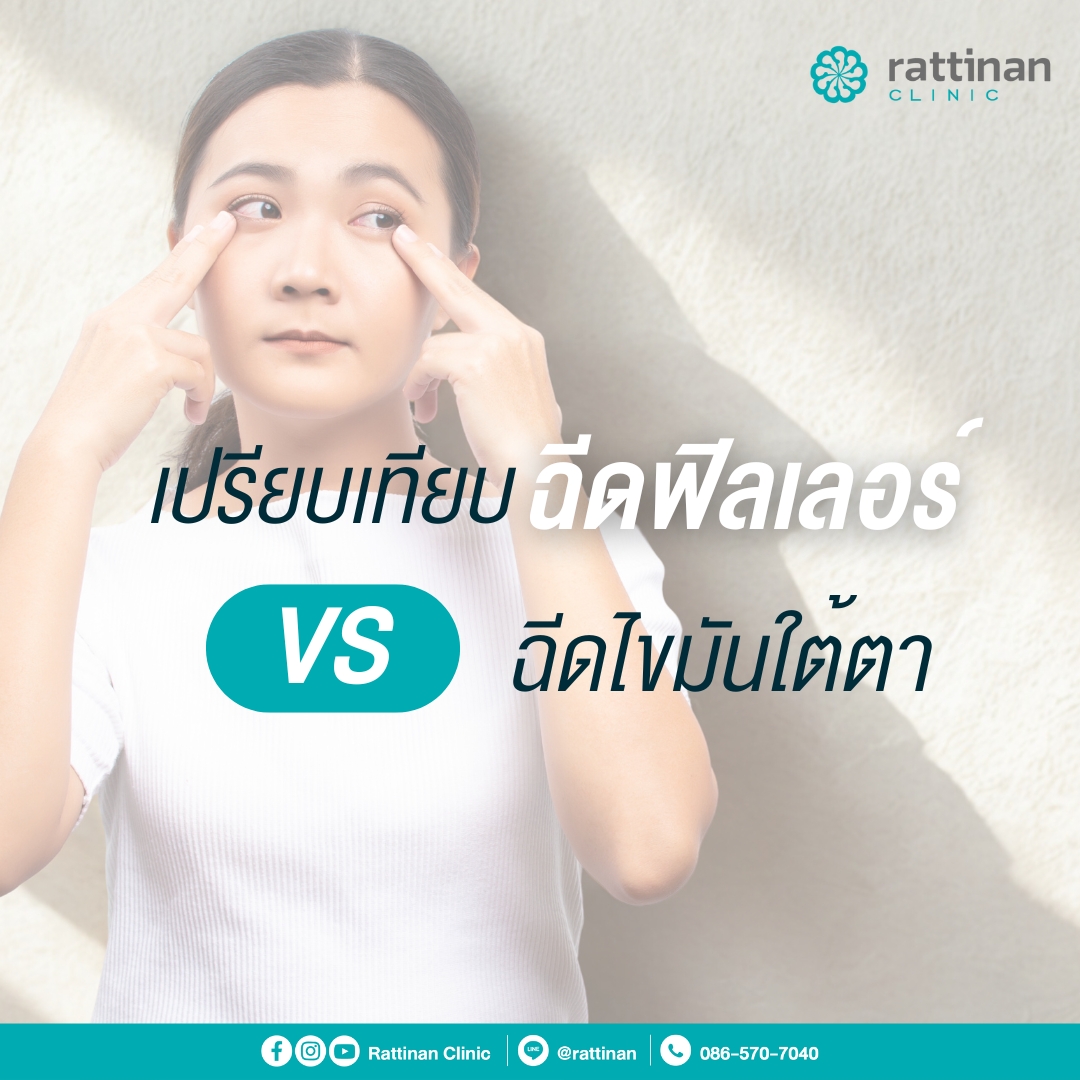 เปรียบเทียบ ฉีดฟิลเลอร์ VS ฉีดไขมันใต้ตา