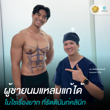 Gynecomastia Testimonial - 1 - Thrid