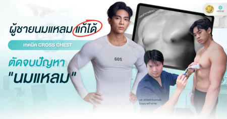 ตัดจบปัญหานมแหลม รีวิว