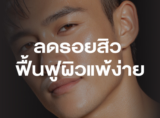ฟื้นฟูผิวจากรอยสิว