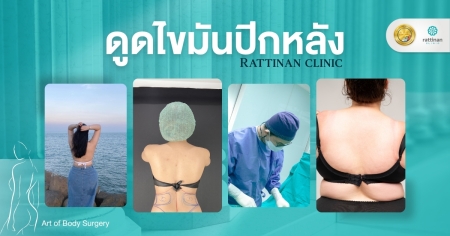 ดูดไขมันปีกหลัง