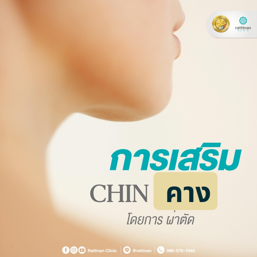 การเสริมคาง