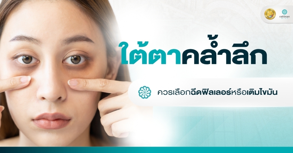 ใต้ตาคล้ำลึก ควรเลือกฉีดฟิลเลอร์หรือเติมไขมัน