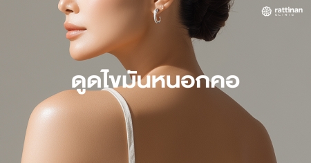 ดูดไขมันหนอกคอ