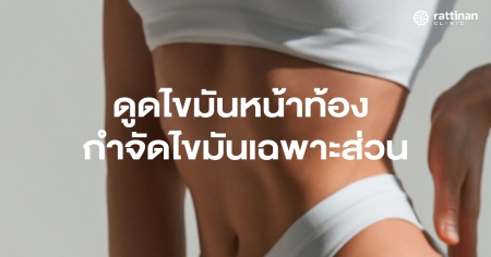 ดูดไขมันหน้าท้อง