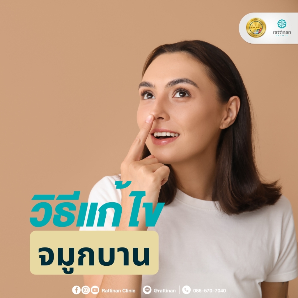 วิธีแก้ไขจมูกบาน