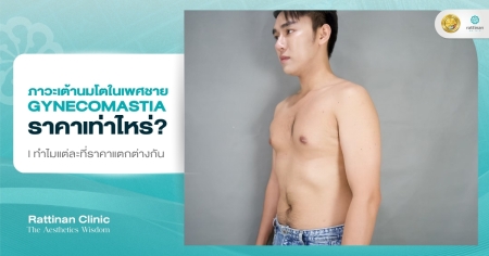 Gynecomastia ราคาเท่าไร