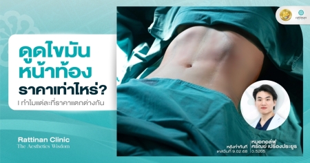 ดูดไขมันหน้าท้องราคา