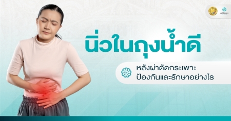 นิ่วในถุงน้ำดี