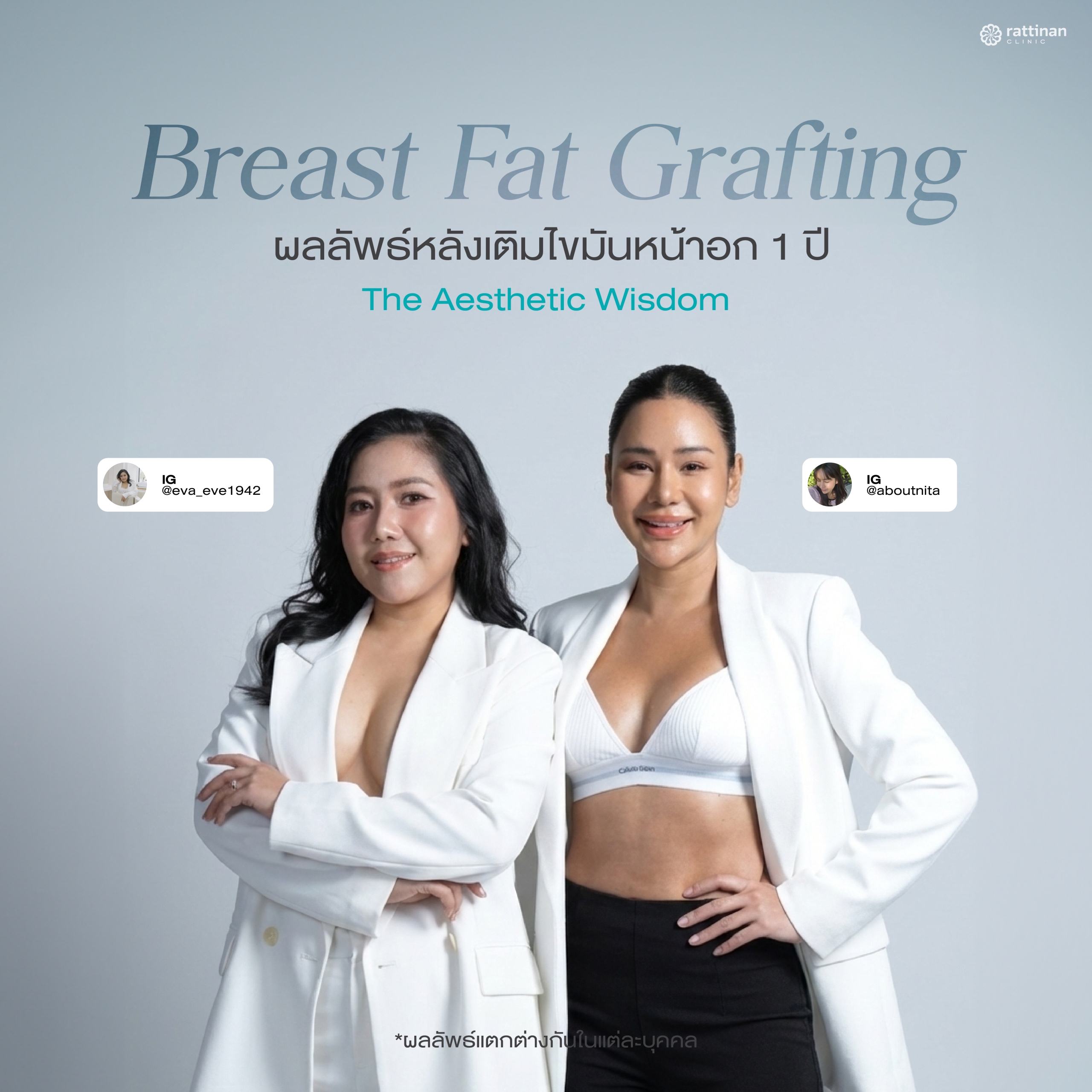 รีวิว ฉีดไขมันหน้าอก หลังทำ 1 ปี Rattinan Clinic