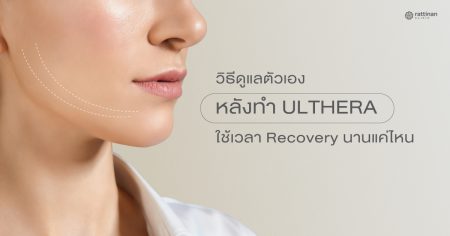 หลังทํา Ulthera หน้าบวมกี่วัน