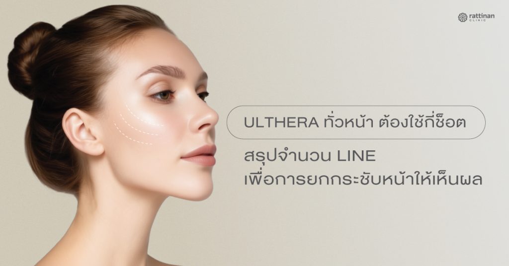 ทำ Ulthera ทั่วหน้า กี่ช็อต