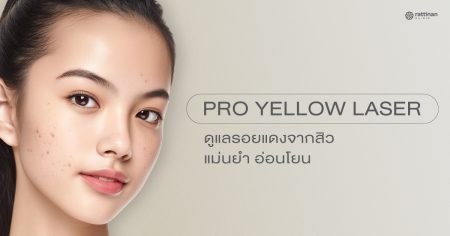 Pro yellow laser เลเซอร์กำจัดรอยแดงจากสิว