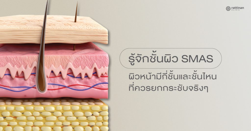 SMAS คืออะไร?
