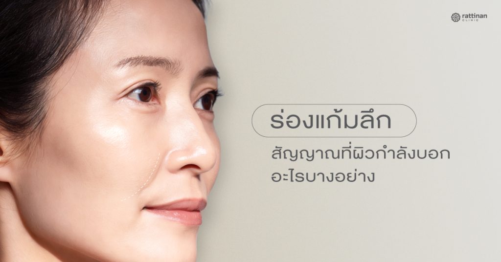 ร่องแก้มลึก จากอะไร วิธีแก้