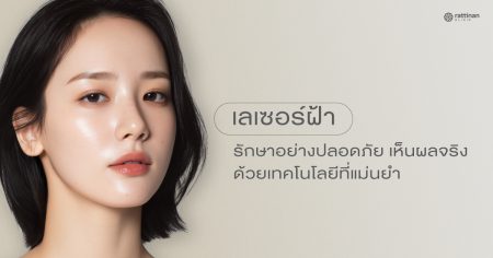 เลเซอร์ฝ้า