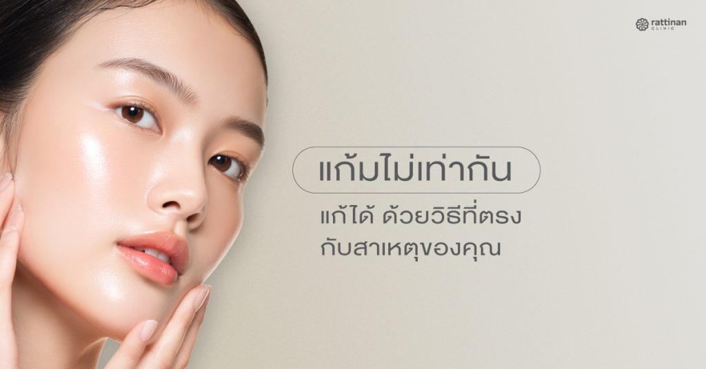 แก้มไม่เท่ากัน