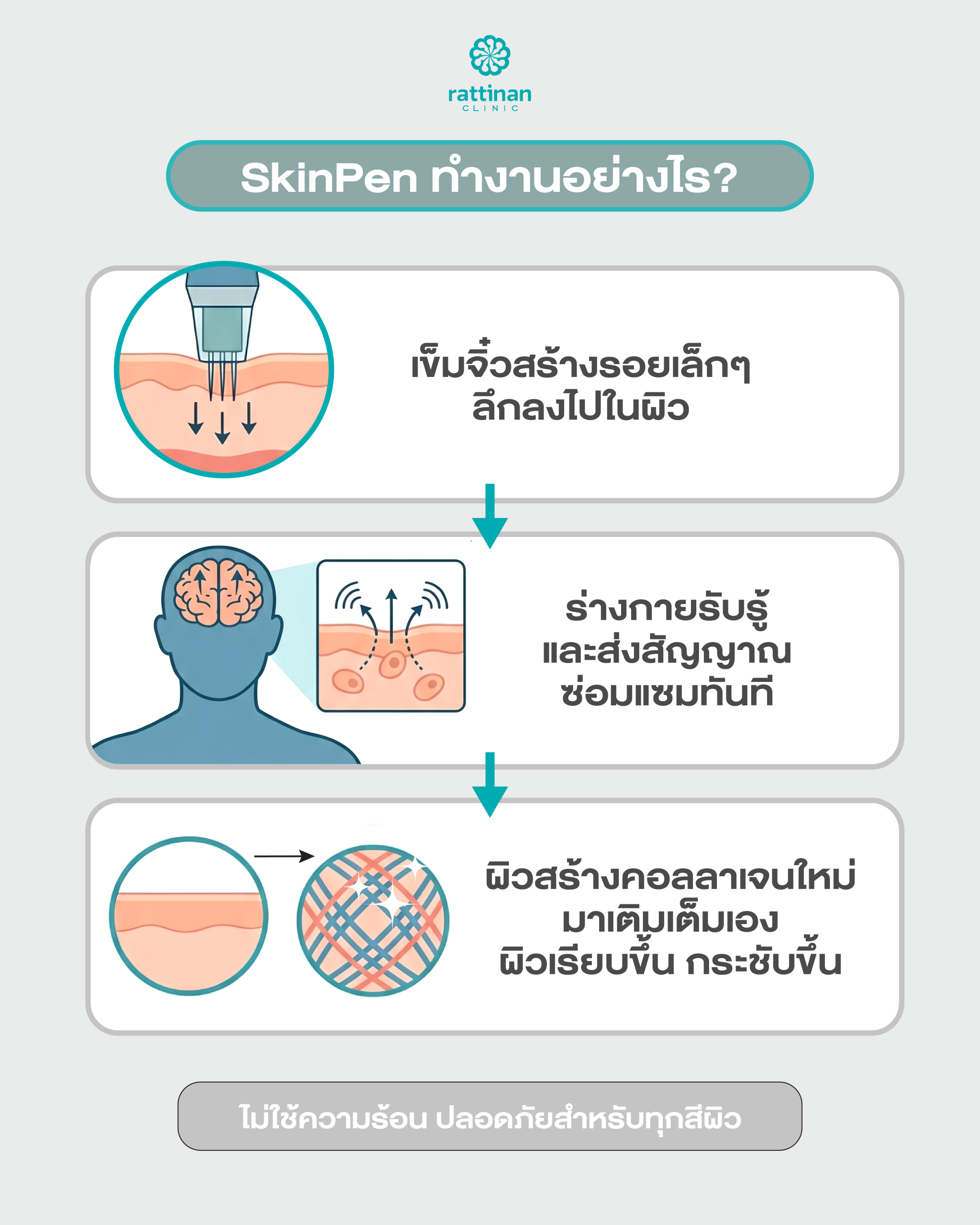 SkinPen คืออะไร
