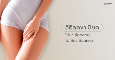 ขาเบียด แสบ แก้ยังไง? รวมวิธีลดขาเบียดให้เรียวสวย มั่นใจทุกการเคลื่อนไหว