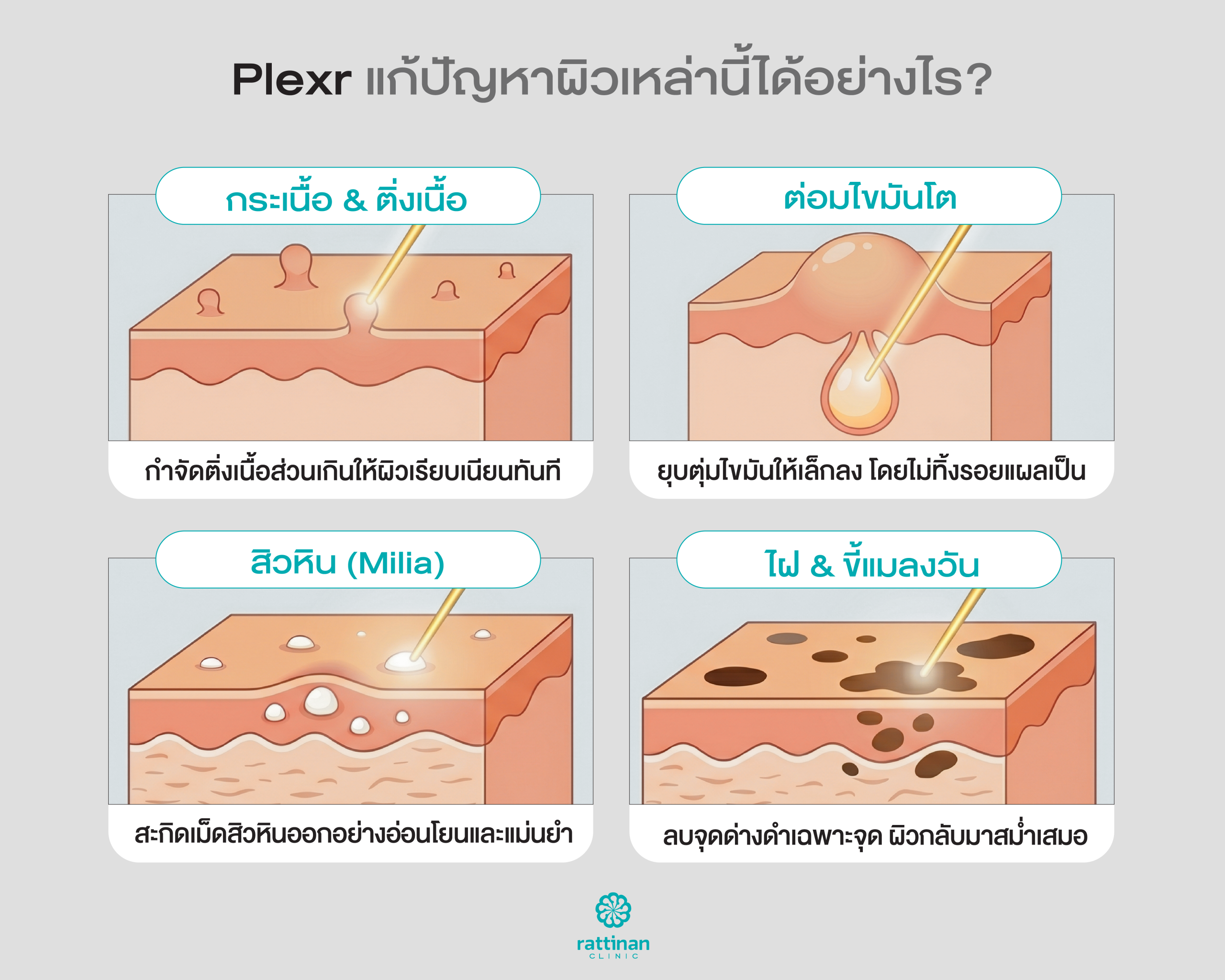 Plexr ช่วยอะไรได้บ้าง