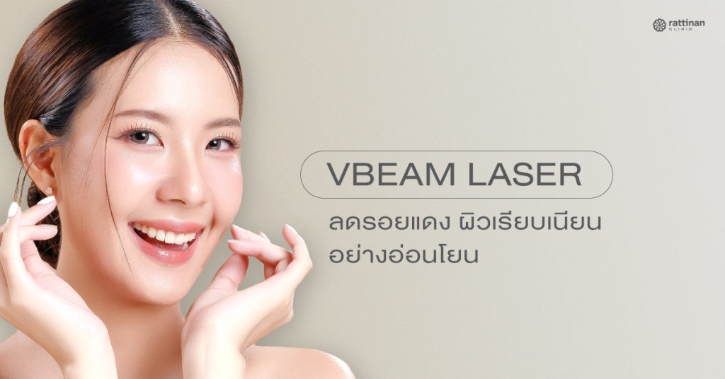 Vbeam laser (วีบีม) ลบรอยแดงจากสิว