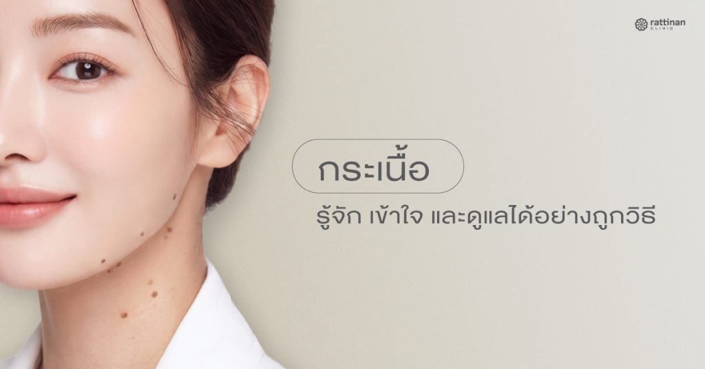 กระเนื้อ