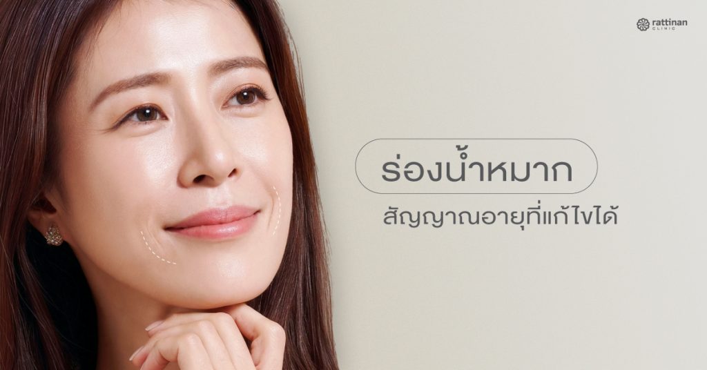 มี ร่องน้ำหมาก คืออะไร