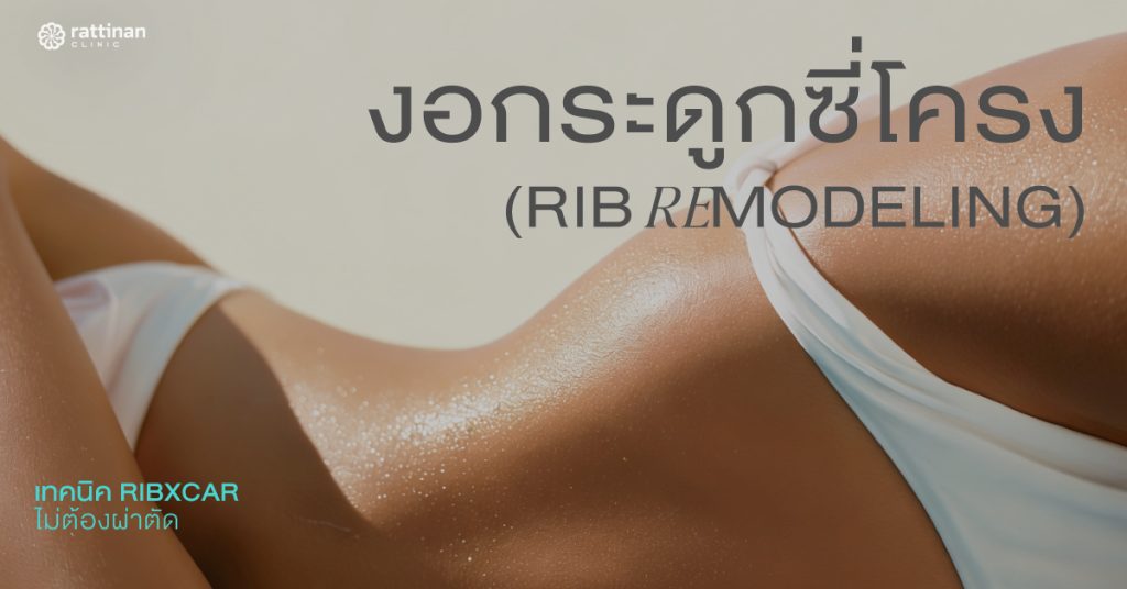 การงอกระดูกซี่โครง (Rib Remodeling)